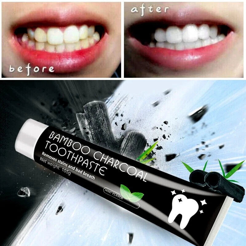 Before and after comparison of teeth with bamboo charcoal toothpaste packaging.